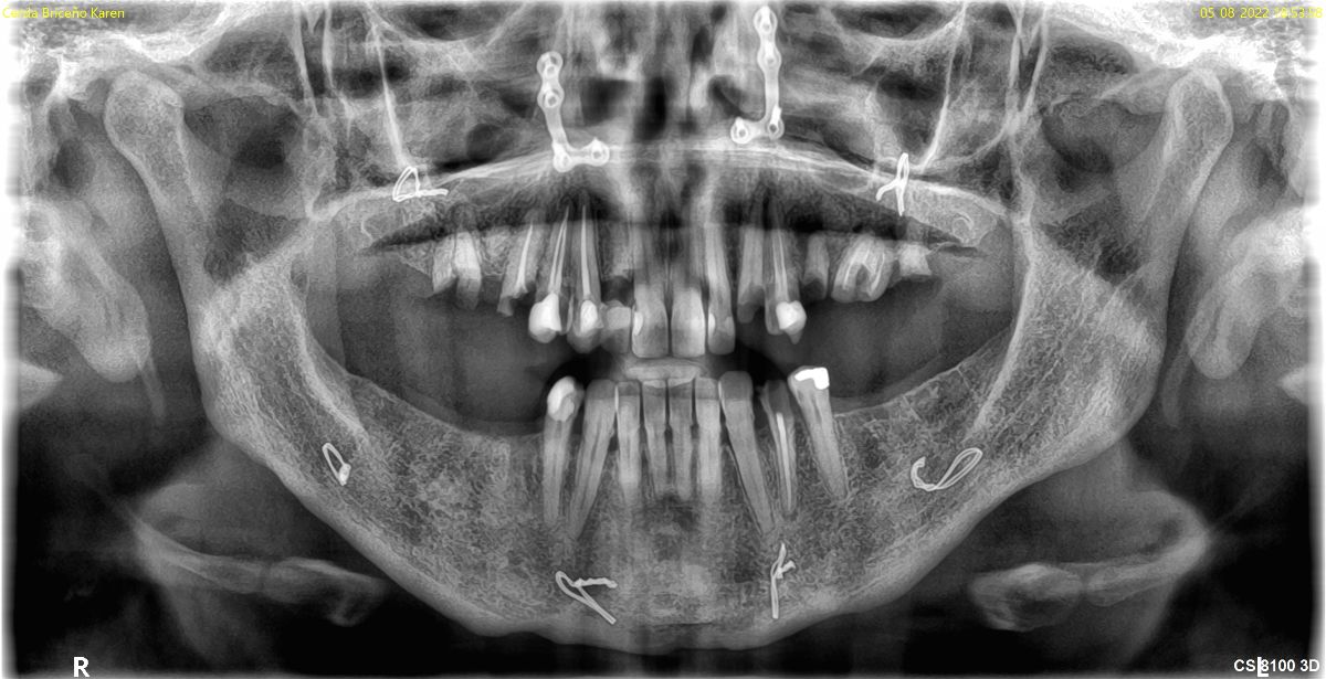 Radiografía Panorámica